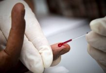 Douala : le Cameroun lance une injection révolutionnaire pour prévenir le VIH prévenir le VIH par injection au cameroun