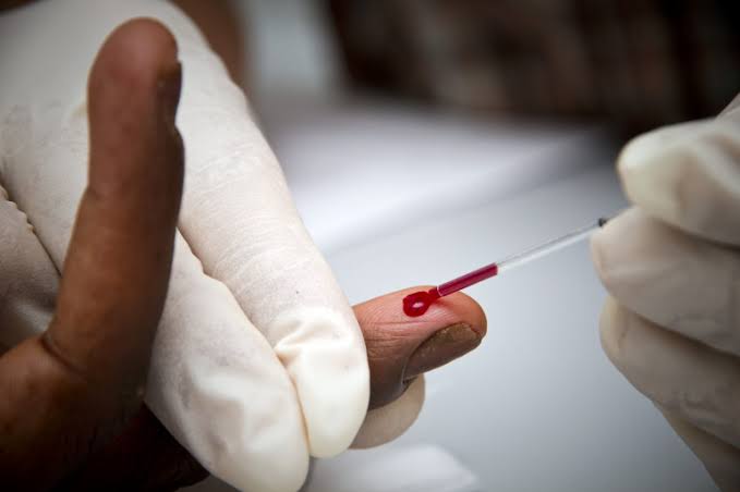 prévenir le VIH cameroun injection prévenir le VIH par injection au cameroun